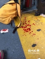 前方车辆突然变道　公交车急刹致女乘客摔倒受伤 - 福州新闻网