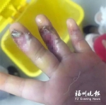 福州3岁女孩被妈妈带到健身馆 手卷入跑步机血肉模糊 - 新浪