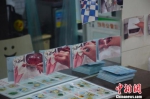 墙上贴着扁肉制作图片提示卡。　刘昌烨 摄 - 福建新闻