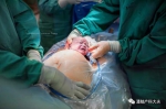 福州一产妇生下“哪吒宝宝” 特别剖宫产保护早产儿 - 新浪